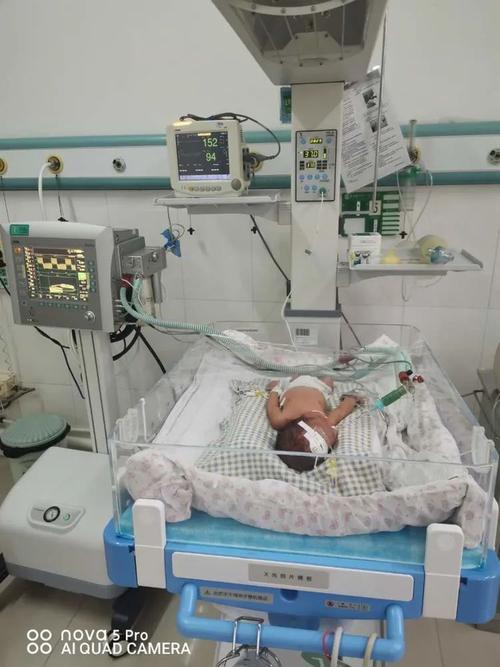 我院首例应用高频呼吸机成功抢救危重早产儿_新生儿