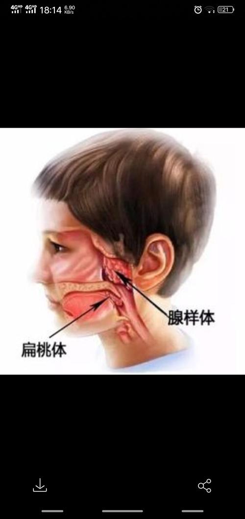 腺样体与扁桃体区别