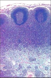 网易博客网站关停,迁移的公告