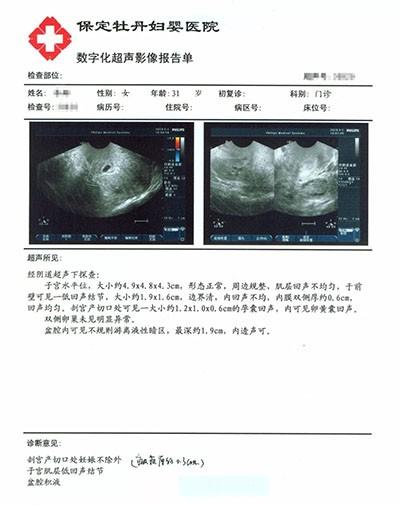 了自己最为信赖的保定牡丹妇婴医院及专家团队,遂来我院行彩超检查,并