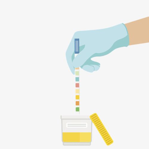 戴着蓝色手套正在检验尿液卡通免抠素材免费下载_觅51