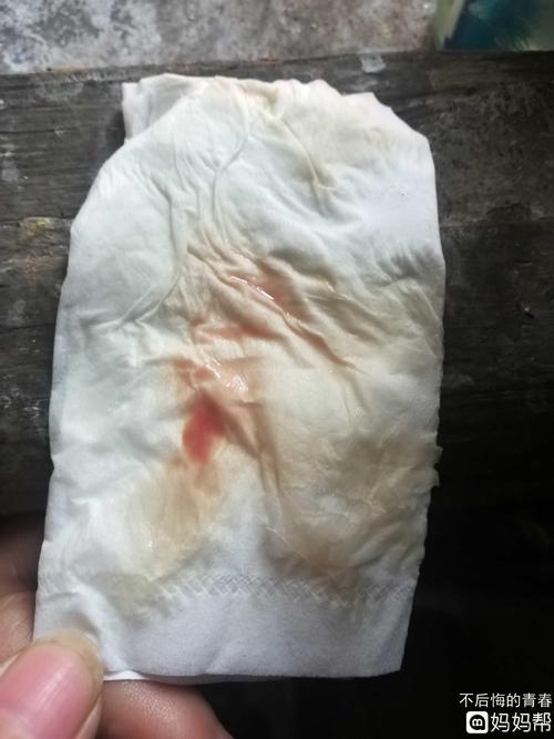 昨天今天有褐色的白带,请问正常吗?