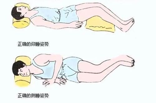 上海市第十人民医院 最好的睡姿应该是平躺和侧躺,而且要注意让脊柱