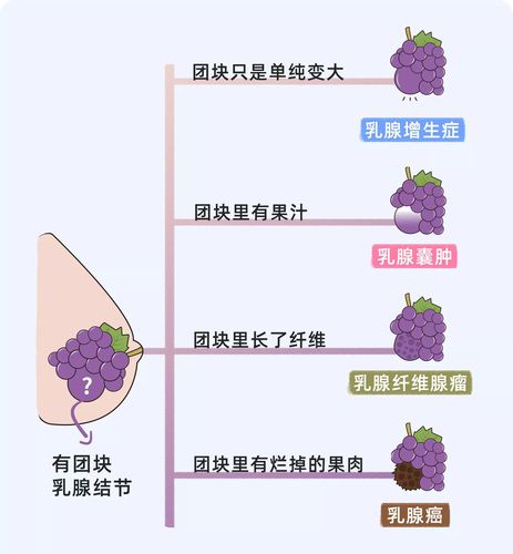 女性有乳腺结节还能买保险吗
