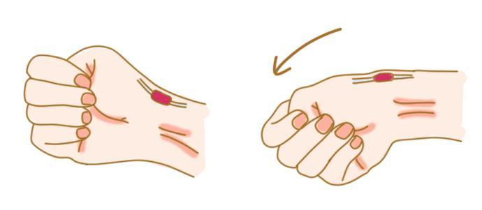 1个动作判断手腕腱鞘炎,医生教你4个方法摆脱它