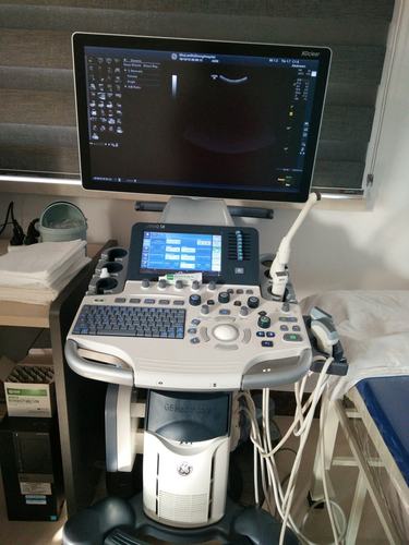 科室现有先进的彩色多普勒超声诊断仪两台:美国ge-logiqs8,飞利浦―