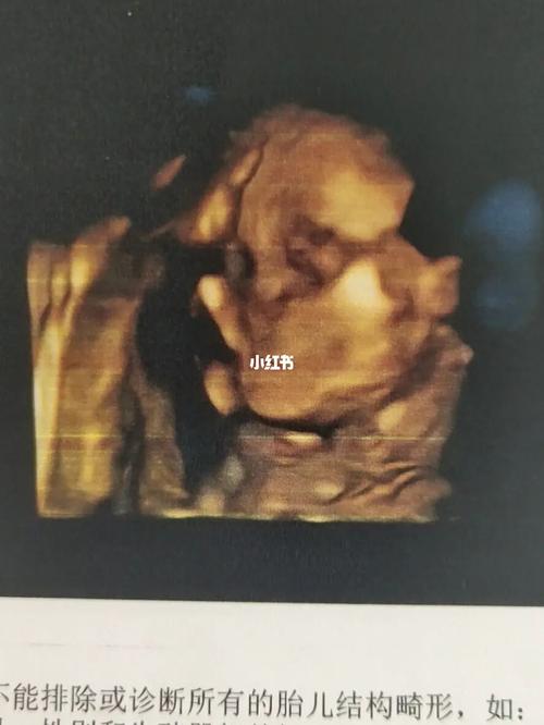 你们家宝生出来跟四维照片一样吗_四维彩超_母婴_孕产