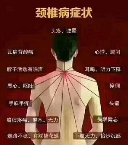 腰间盘突出椎管狭窄坐骨神经痛贴仙草活骨膏