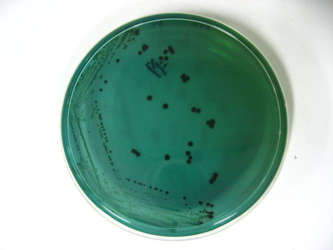 检测沙门氏菌时,he平板出现一大片红色的还有黑色点点