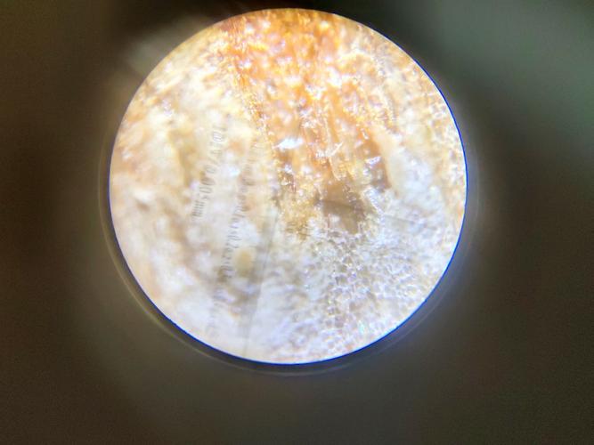 医院用的沉香显微图.