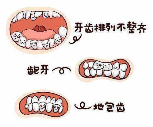 吃手和安抚奶嘴的危害比较常见的是牙齿畸形 但这个概率并不大.