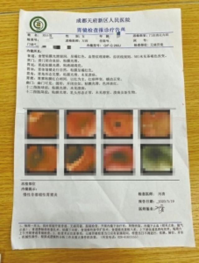 刘小雪的胃镜检查报告.