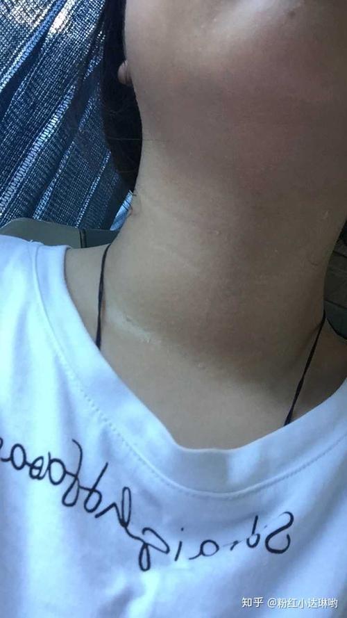 当时都没脖子和锁骨