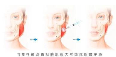 爱嚼口香糖影响脸型怎么改善?