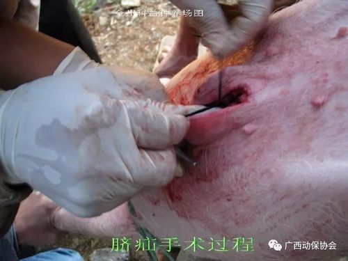 【诊疗】脐疝的治疗(附手术图解)