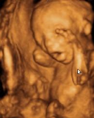 只需照个"b超"就能看到"胎儿写真"--3维彩照