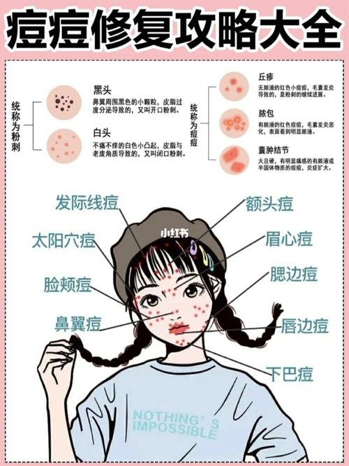 看图了解自己最真实长痘原因99 不同位置的痘痘出现