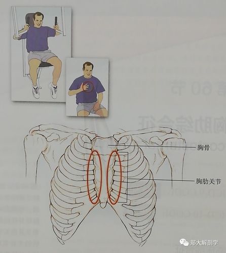 八种引起胸部疼痛综合征