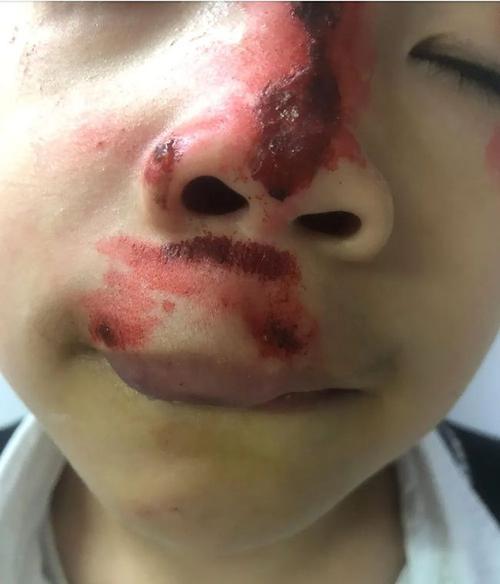 梧州一名女子撞跌小学生逃逸!孩子严重受伤
