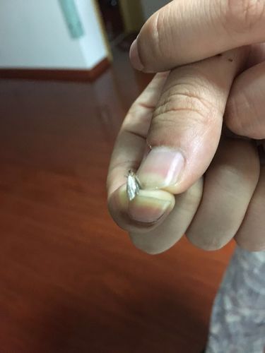 家里最近出现挺多的小飞蛾,也找不到在哪里出来的.