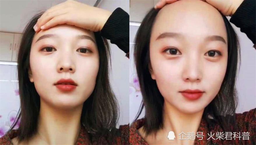 "发际线"太高对女生颜值影响有多大?撩起刘海后,男生拔腿就跑