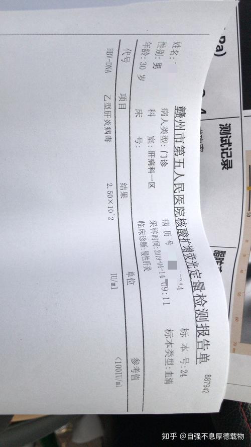 先来两张化验单吧!希望广大乙肝病毒携带者对自己有信心!