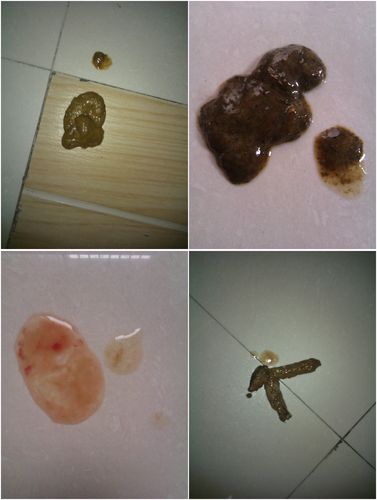 我的狗狗患细小第六天了,一直在输液,不拉肚子了,但是一直持续呕吐,或