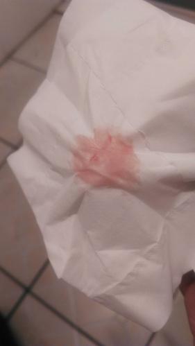 同房第十二天开始出血,前两天是褐色的,今天是这个样,有人和我有同样