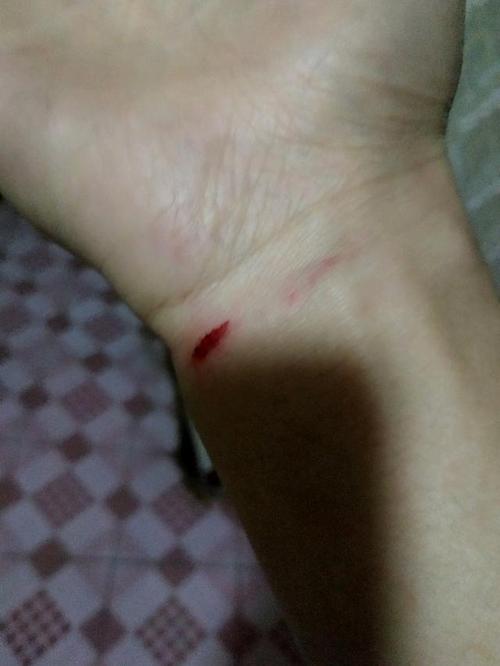 手腕也被划伤了.