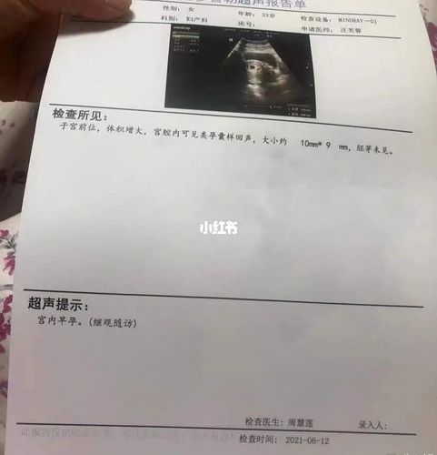 人流过程分享,术后我一定要做好护理_子宫_白带_棉签
