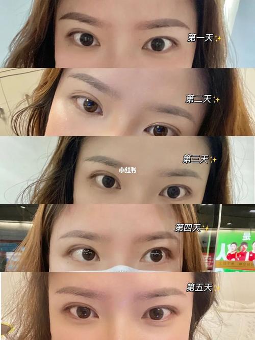 长沙纹眉|分享恢复期全过程记录!