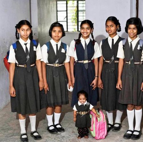 世界上最矮的女人,23岁身高仅有63cm,体重只有6公斤!