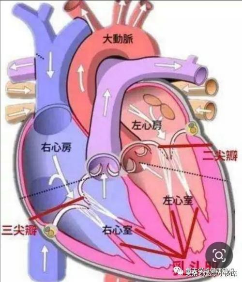 二尖瓣关闭不全是怎么回事