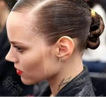 成都美容整形医院植发中心 | 面部轮廓 | 毛发种植 | 种植发际线 | 微