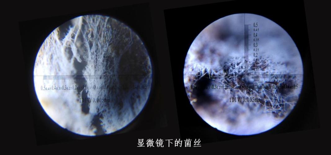 图18. 显微镜下的菌丝