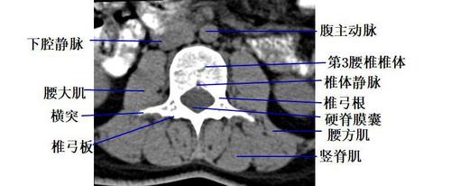 经腰椎椎体下部的横断层面(ct )