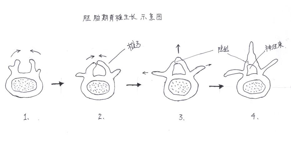 脊椎及隐裂示意图