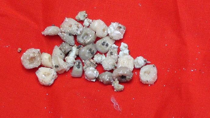 火化后发现大约30颗舍利子