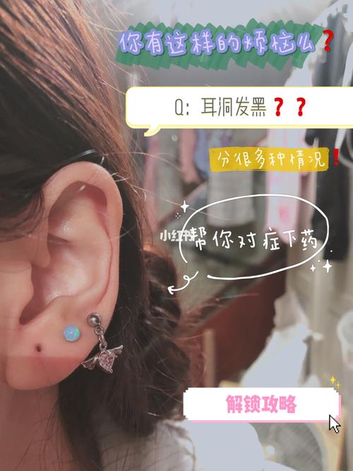 干货|关于耳洞发黑那些事_耳洞_耳钉_色素沉淀_合金_棉签_耳洞护理