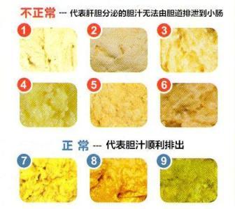 九个月宝宝一天要拉两三次大便跟羊屎蛋蛋一样正常吗