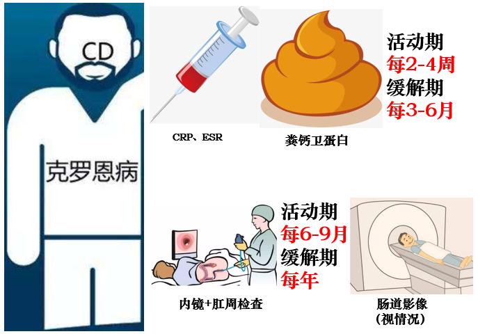 克罗恩病