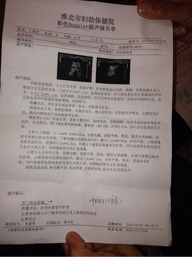 肝小血管瘤保险拒保吗-列表网问答 肝部血管瘤保险公司拒保吗