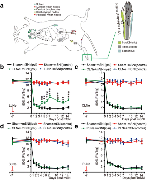 cd4  αβ t cell infiltration into the leptomeninges of lumbar