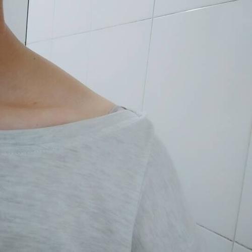 肩部有两个硬块是怎么回事