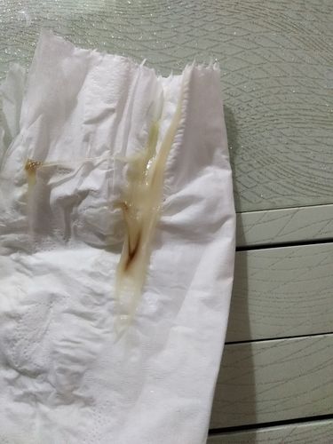 怀孕五个月了,出现了这种情况怎么办.