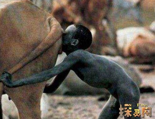 世界上最大的睾丸,韦斯利·沃伦睾丸重达120斤(图片)