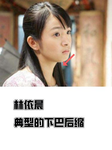 对于下巴后缩的脸型最典型的就是林依晨了 脸部特点 可爱的娃娃脸