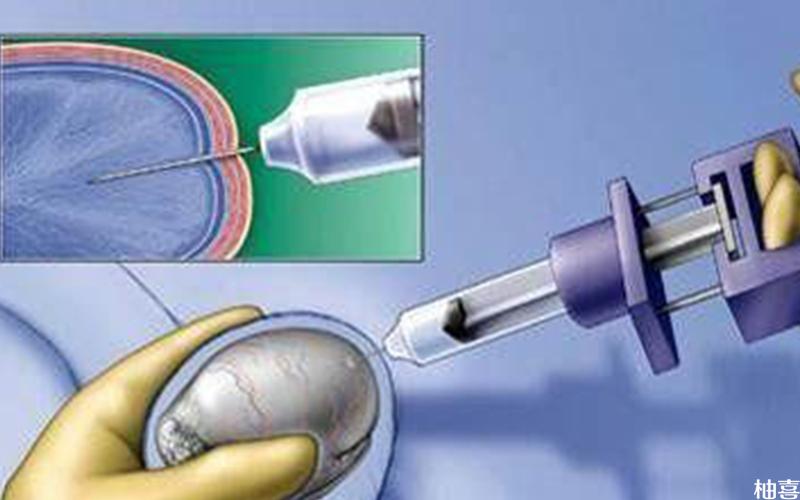 睾丸穿刺是通过注射器提取睾丸组织