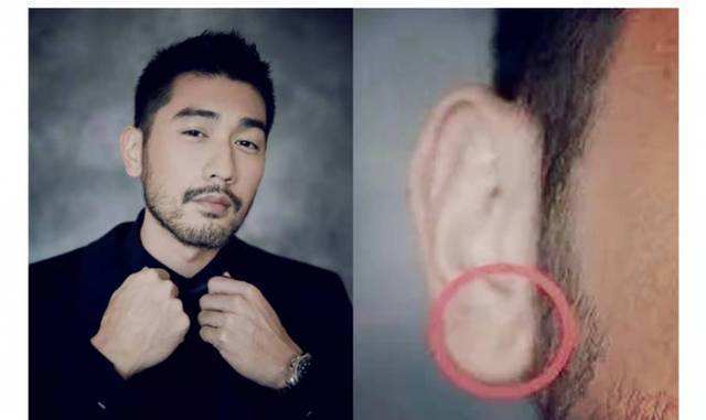 因此,双耳出现明显折痕的人患有冠心病的可能性会大大增加.