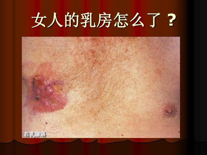 关爱女性健康ppt